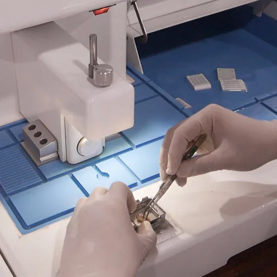 ศูนย์ฝังศูนย์การแพทย์ X เรย์การได้ยินเสียงเครื่องวัดระดับน้ำตาลในเลือดตรวจวัดระดับน้ำตาลในเลือดแบบพกพาวิเคราะห์ศูนย์ฝัง